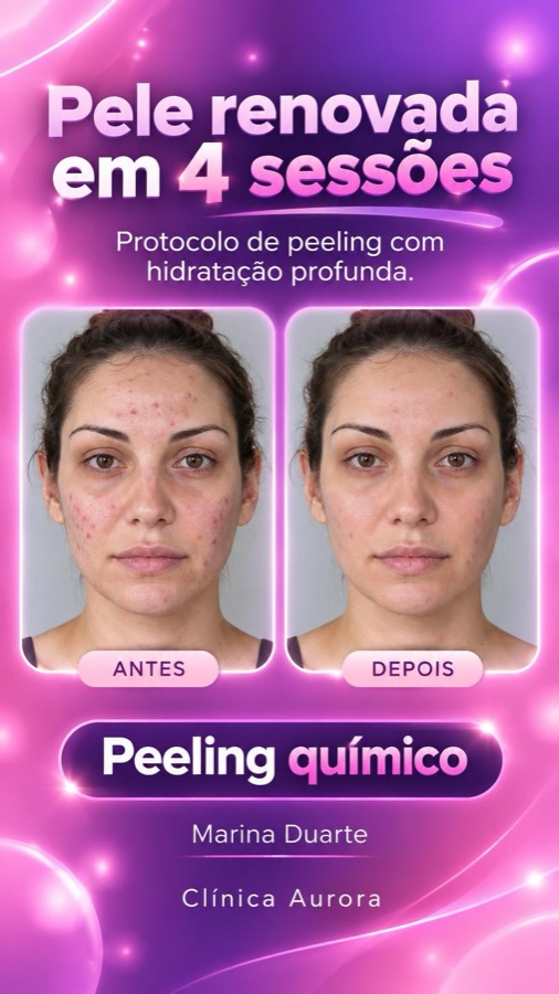 Exemplo de story no modelo Glow vibrante, com antes e depois.